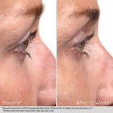 Nu-Cil™ Eyelash Enhancing Serum
