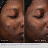 Retinol + PHA Refining Night Cream