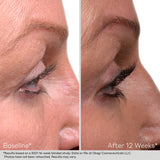 Nu-Cil™ Eyelash Enhancing Serum