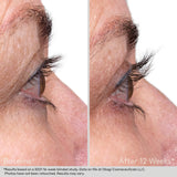 Nu-Cil™ Eyelash Enhancing Serum